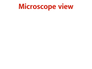 Microscope view 
 