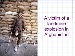 A victim of a
landmine
explosion in
Afghanistan
 