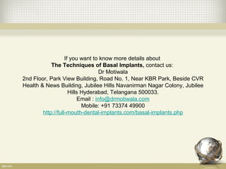 If you want to know more details about
The Techniques of Basal Implants, contact us:
Dr Motiwala
2nd Floor, Park View Building, Road No. 1, Near KBR Park, Beside CVR
Health & News Building, Jubilee Hills Navanirman Nagar Colony, Jubilee
Hills Hyderabad, Telangana 500033.
Email : info@drmotiwala.com
Mobile: +91 73374 49900
http://full-mouth-dental-implants.com/basal-implants.php
 