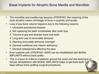 Basal Implants for Atrophic Bone Maxilla and Mandible:
• The mandible and maxilla may become ATROPHIC (the meaning of the
word atrophic means shrinkage of bone in quantity and quality
• Loss of jaw bone volume happens due to the following reasons:
1. Untreated periodontal disease
2. Not replacing the teeth immediately after tooth loss
3. Trauma to jaw and alveolar bone and teeth
4. Long term use of removable dentures
5. Wearing removable dentures overnight
6. General nutritional and vitamin deficiency
7. General osteoporosis affecting the jaws
• Even patients with ATROPHIC JAWS can be rehabilitated with BASAL
IMPLANTS without bone grafts.
• This is a boon to millions of patients around the world and this technique of
full jaw rehabilitation with BASAL IMPLANTS helps to get fixed teeth in 3
days without bone grafting surgical procedures.
 