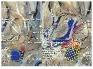 The temporal bone and transtemporal approaches | PPTX