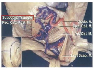 The temporal bone and transtemporal approaches | PPTX