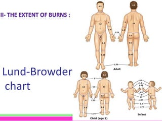 Lund-Browder
chart
SARA AL-GHANEM

17

 