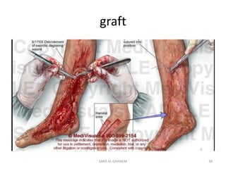 graft

SARA AL-GHANEM

38

 