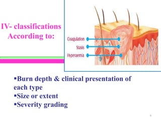 IV- classifications
According to:

Burn depth & clinical presentation of
each type
Size or extent
Severity grading
6

 