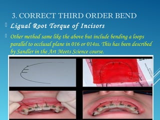 The Third Stage Of Comprehensive Treatment The Third Stage Of Comprehensive Treatment