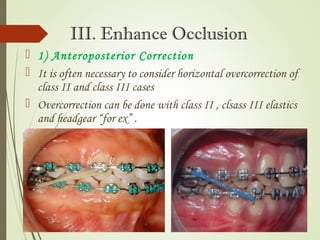The Third Stage Of Comprehensive Treatment The Third Stage Of Comprehensive Treatment