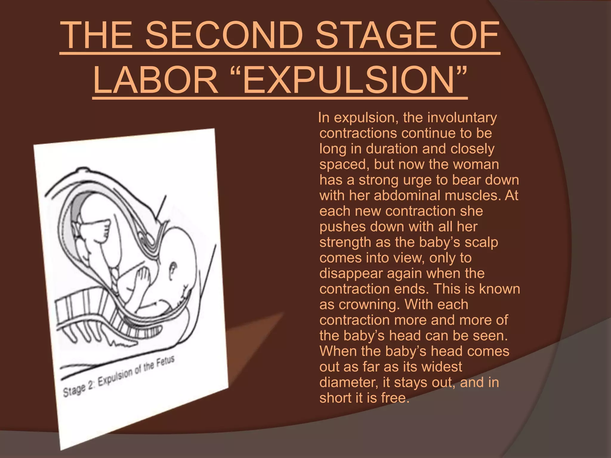 THE SECOND STAGE OF LABOR “EXPULSION”      In expulsion, the involuntary contractions continue to be long in duration and closely spaced, but now the woman has a strong urge to bear down with her abdominal muscles. At each new contraction she pushes down with all her strength as the baby’s scalp comes into view, only to disappear again when the contraction ends. This is known as crowning. With each contraction more and more of the baby’s head can be seen. When the baby’s head comes out as far as its widest diameter, it stays out, and in short it is free. 