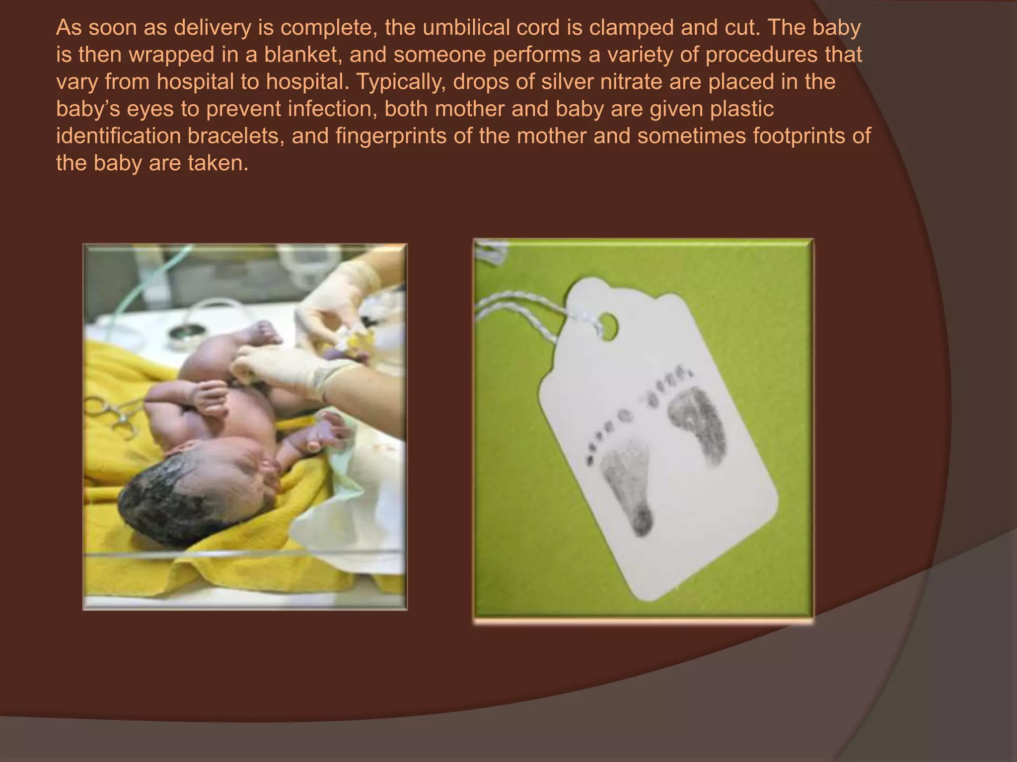 As soon as delivery is complete, the umbilical cord is clamped and cut. The baby is then wrapped in a blanket, and someone performs a variety of procedures that vary from hospital to hospital. Typically, drops of silver nitrate are placed in the baby’s eyes to prevent infection, both mother and baby are given plastic identification bracelets, and fingerprints of the mother and sometimes footprints of the baby are taken. 