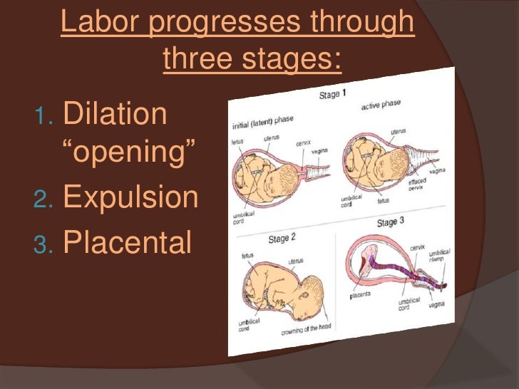 The Three Stages Of Labor And Delivery