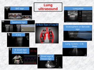 TheTransformative Role of Ultrasound in Critical Care ppt.pptx