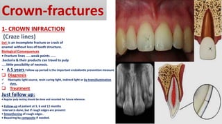 Infraction Tooth The traumatic dental injuries.pdf
