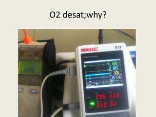 O2 desat;why? 
 