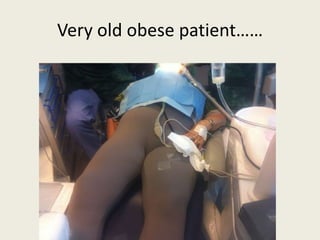 Very old obese patient…… 
 