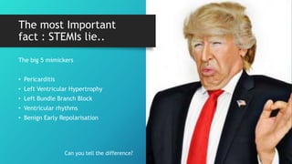 The most Important
fact : STEMIs lie..
The big 5 mimickers
• Pericarditis
• Left Ventricular Hypertrophy
• Left Bundle Branch Block
• Ventricular rhythms
• Benign Early Repolarisation
Can you tell the difference?
 
