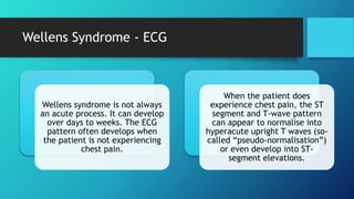 Wellens Syndrome - ECG
Wellens syndrome is not always
an acute process. It can develop
over days to weeks. The ECG
pattern often develops when
the patient is not experiencing
chest pain.
When the patient does
experience chest pain, the ST
segment and T-wave pattern
can appear to normalise into
hyperacute upright T waves (so-
called “pseudo-normalisation”)
or even develop into ST-
segment elevations.
 