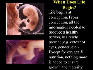 The truth about abortion Slide 6