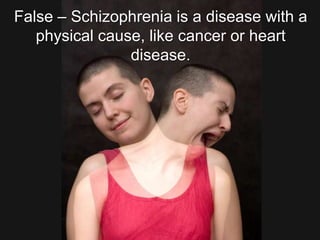 False – Schizophrenia is a disease with a physical cause, like cancer or heart disease. 