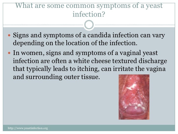 The truth about yeast infection