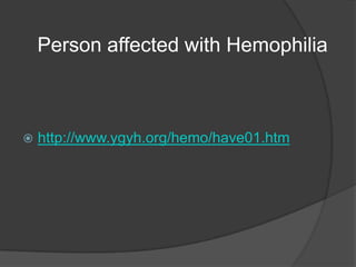 Person affected with Hemophiliahttp://www.ygyh.org/hemo/have01.htm
