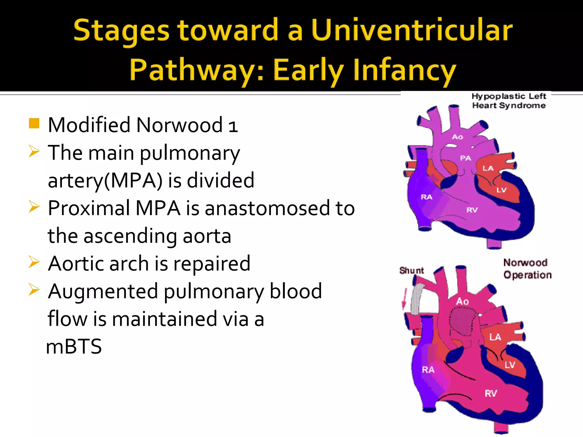 The univentricular repair indications, procedures, outcomes and ...