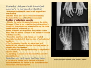 the upper limb | PPTX
