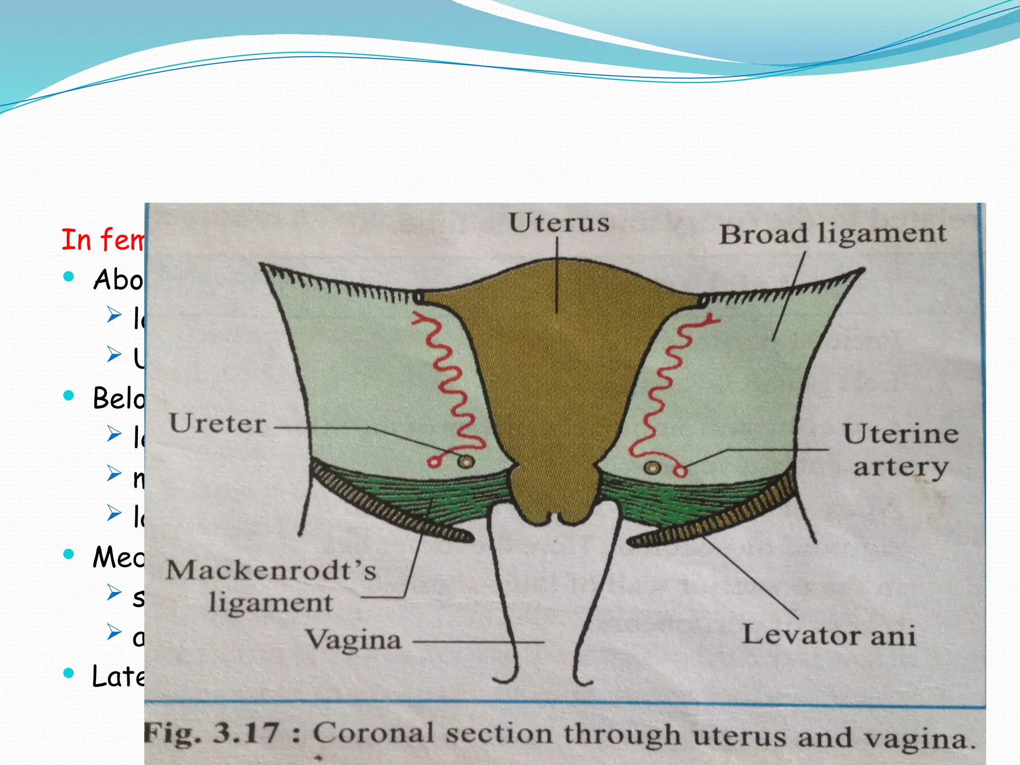 In female,
 Above:
 lower attached margin of broad ligament
 Uterine artery
 Below:
 levator ani muscle
 mackenrodt’s ligament
 lateral fornix of vagina
 Medially:
 supra vaginal part of cervix uteri
 anterior vaginal wall
 Laterally: uterine artery
 