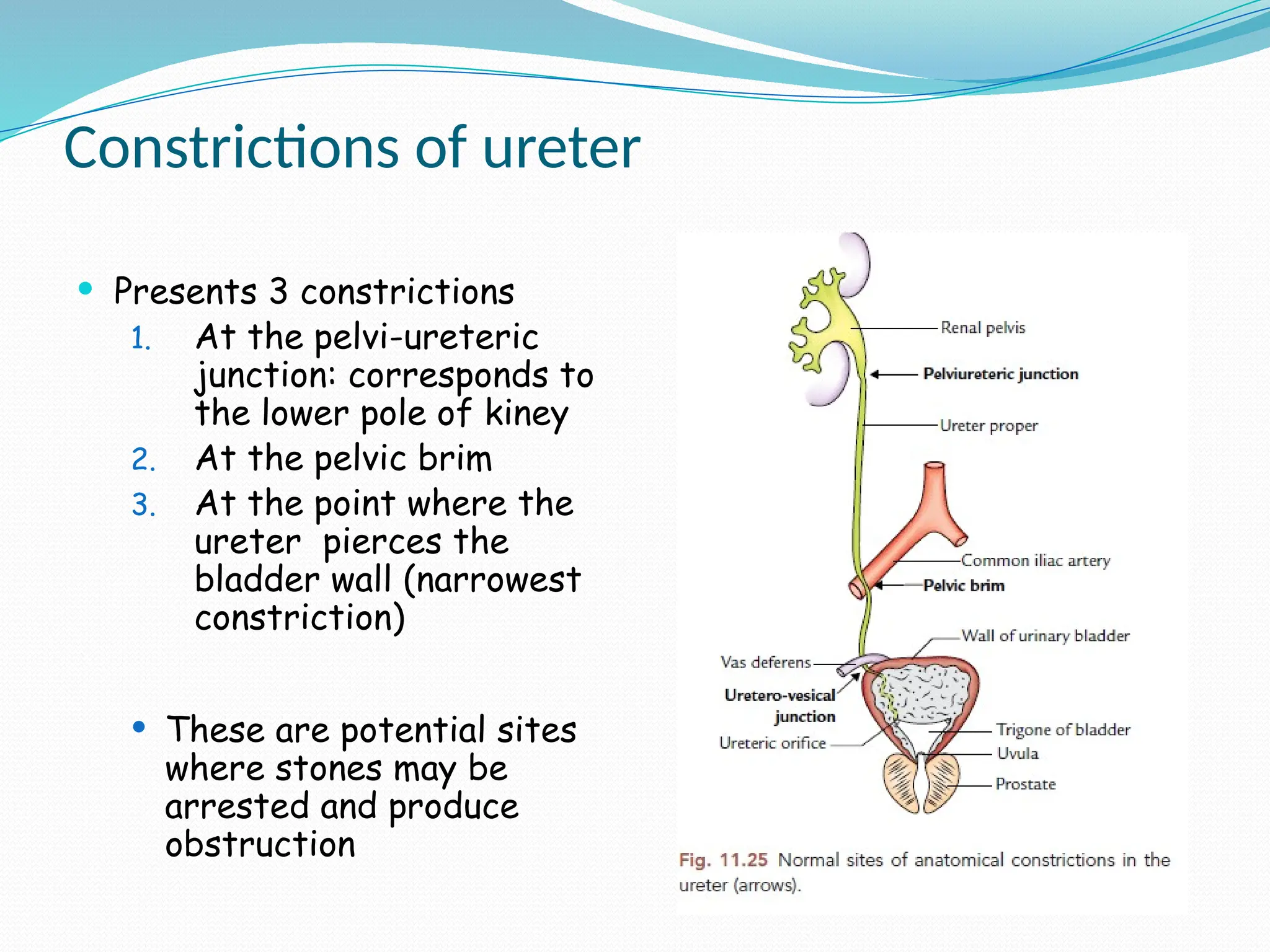 Constrictions of ureter
 Presents 3 constrictions
1. At the pelvi-ureteric
junction: corresponds to
the lower pole of kiney
2. At the pelvic brim
3. At the point where the
ureter pierces the
bladder wall (narrowest
constriction)
 These are potential sites
where stones may be
arrested and produce
obstruction
 