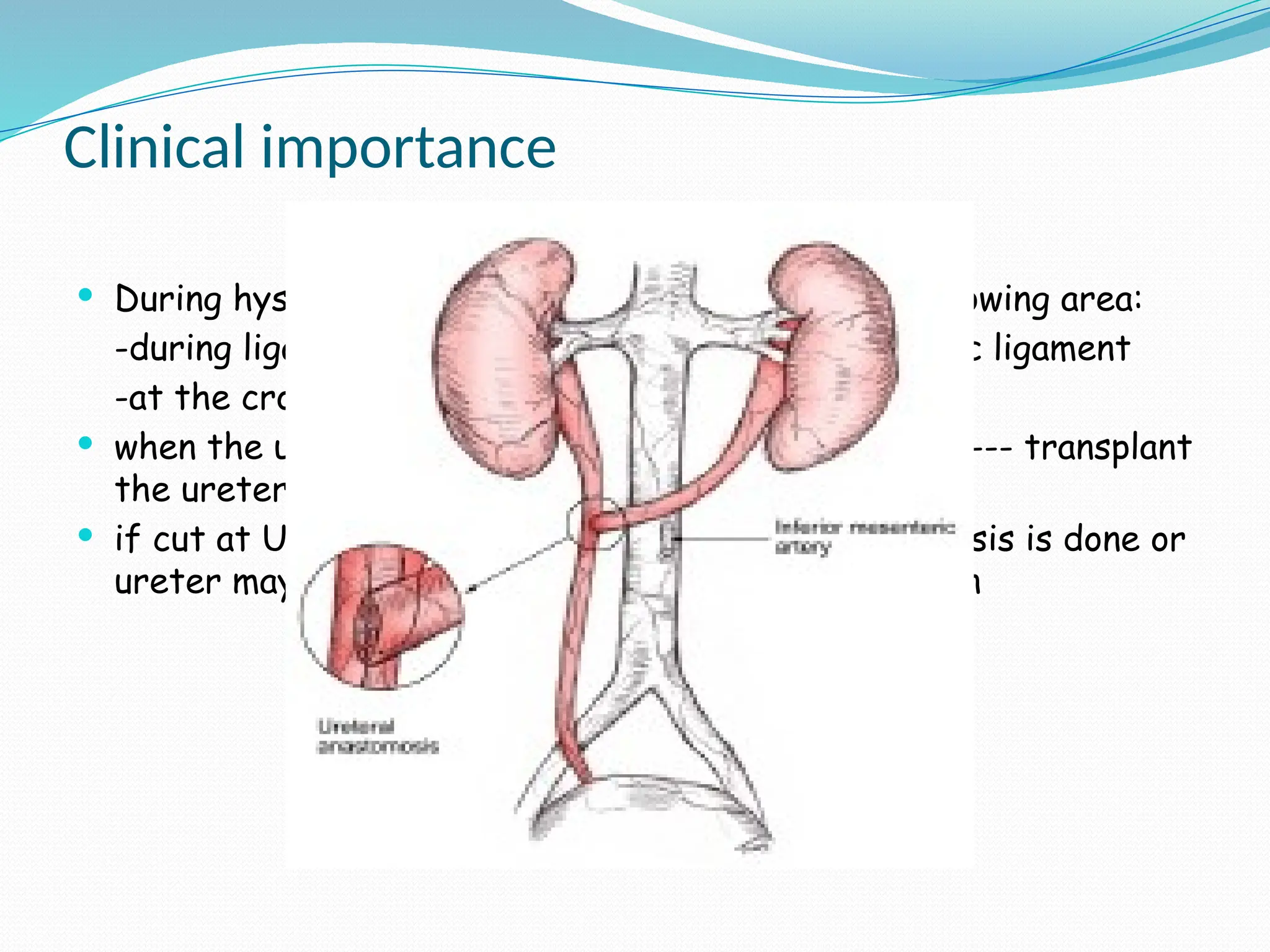 Clinical importance
 During hysterectomy, ureter may be involved in following area:
-during ligation of ovarian vessel in infundibulo pelvic ligament
-at the crossing of ureter and uterine artery
 when the ureter is accidentally cut at LOWER level --- transplant
the ureter to bladder
 if cut at UPPER level --- uretero- ureteric anastomosis is done or
ureter may be transplanted to ileum or sigmoid colon
 