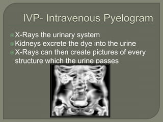  X-Rays the urinary system
Kidneys excrete the dye into the urine
X-Rays can then create pictures of every
structure which the urine passes