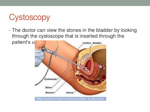 The urinary system The urinary system