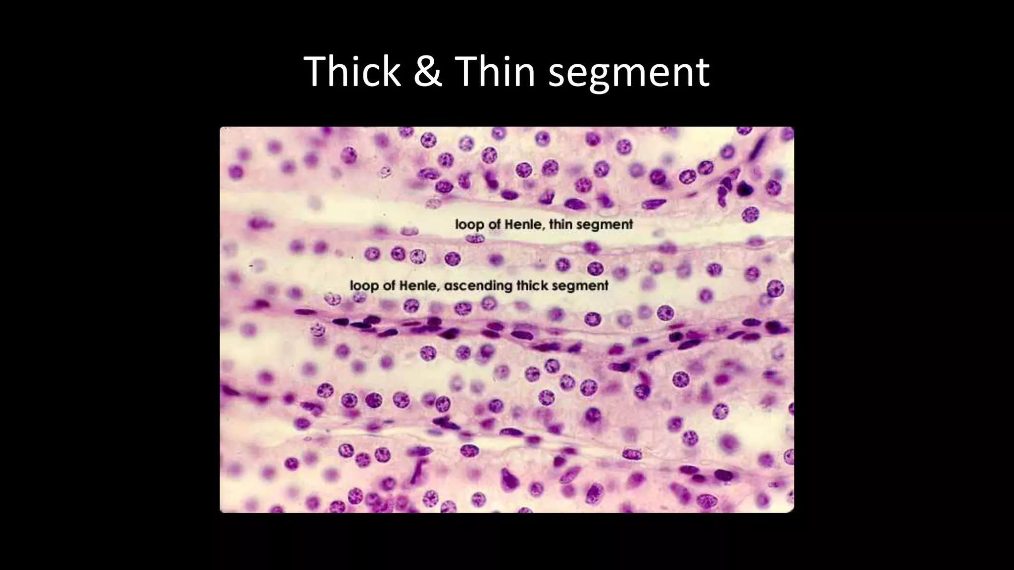 Thick & Thin segment
 