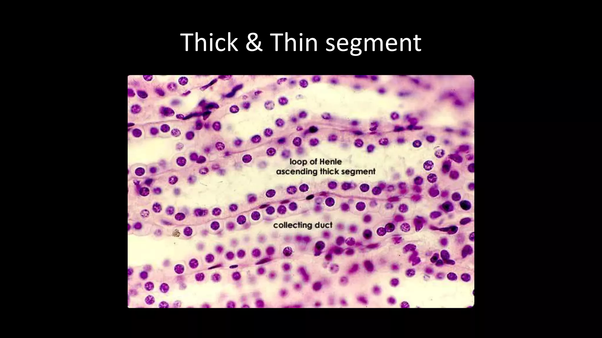 Thick & Thin segment
 