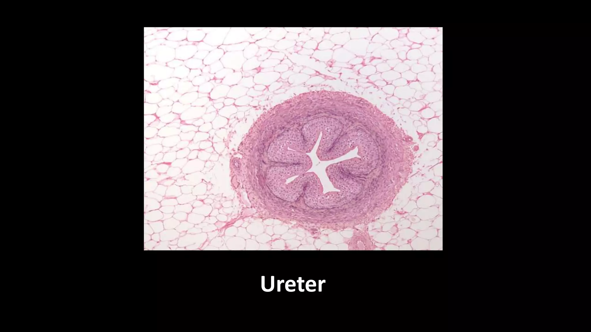 Ureter
 