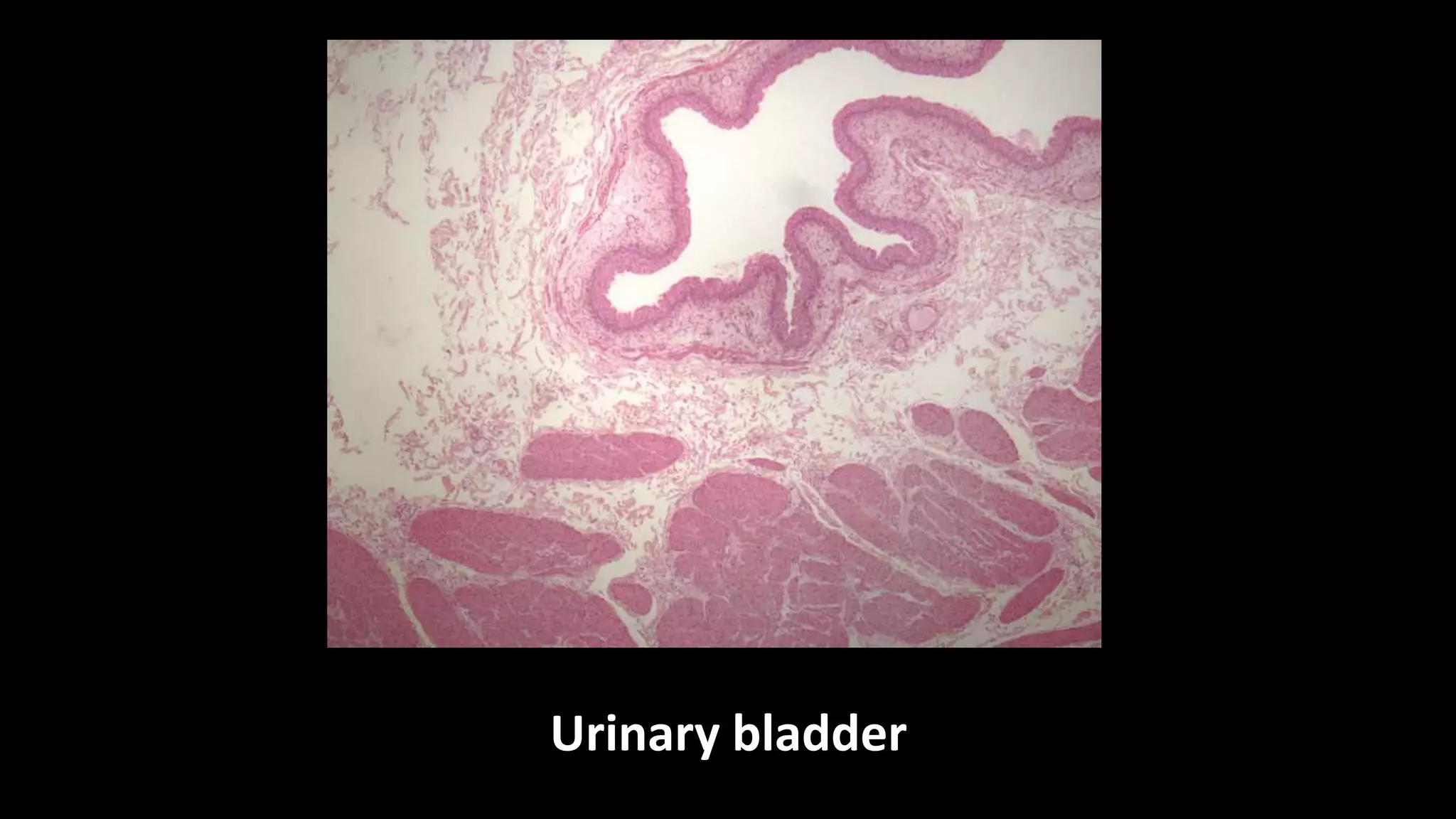 Urinary bladder
 