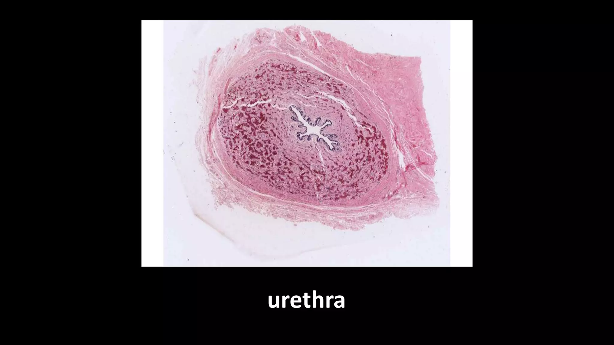 urethra
 