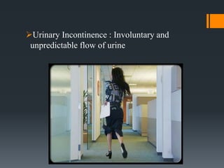 Urinary Incontinence : Involuntary and
unpredictable flow of urine
 