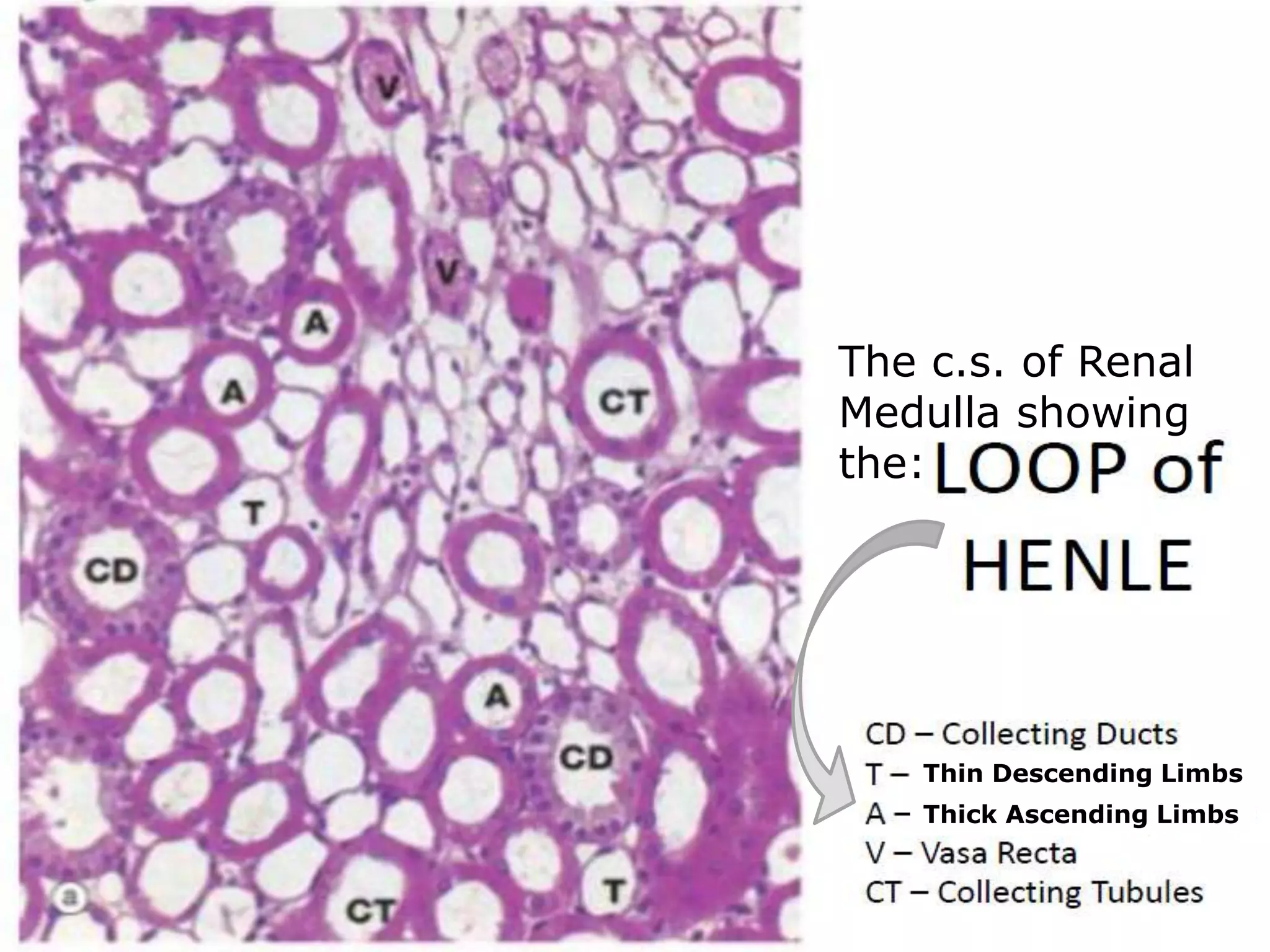 The c.s. of Renal
Medulla showing
the:
Thin Descending Limbs
Thick Ascending Limbs
 