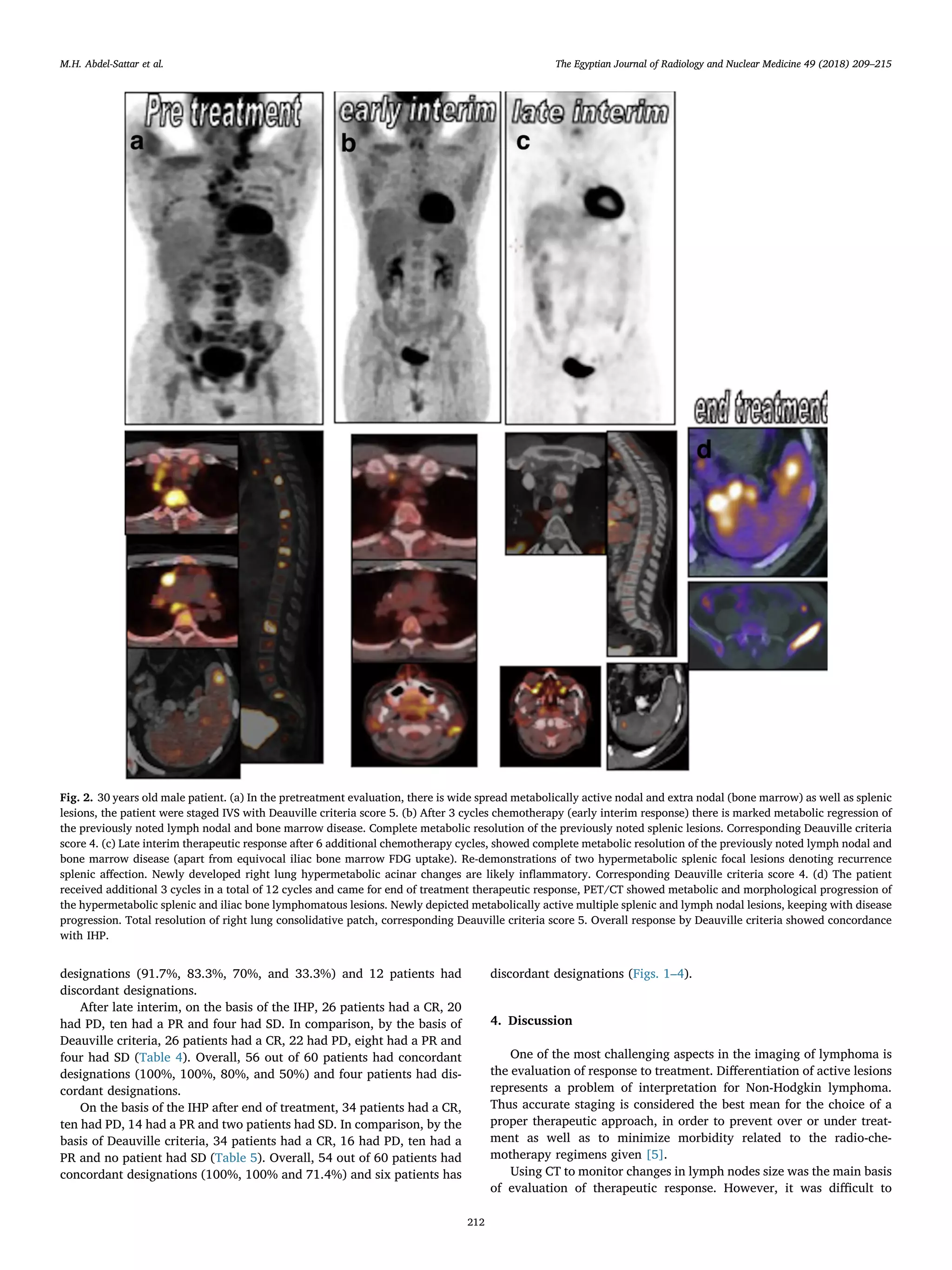 The use of deauville criteria in follow up assessment of response to ...