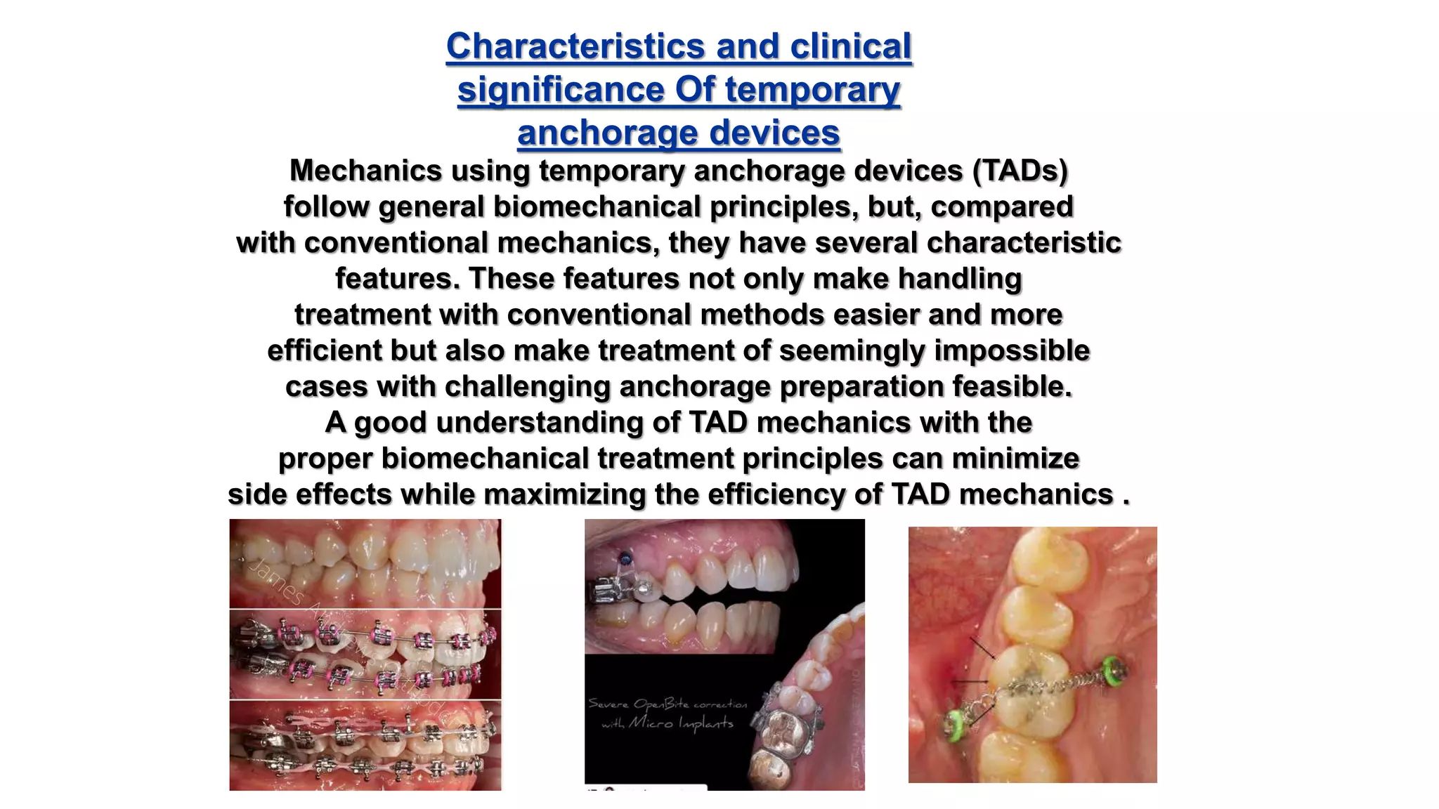 The use of microimplants in orthodontics | PPTX