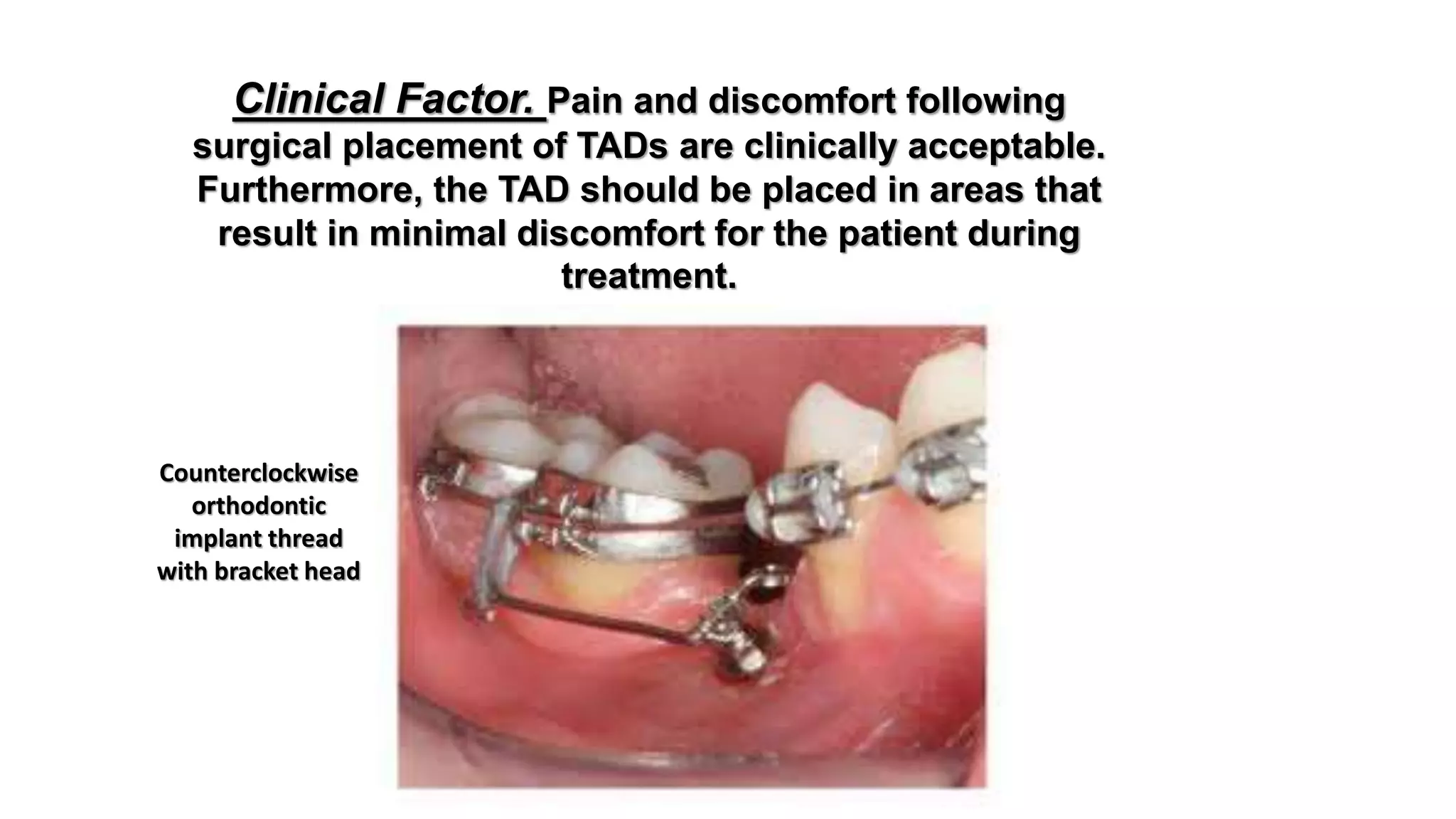 The use of microimplants in orthodontics | PPTX