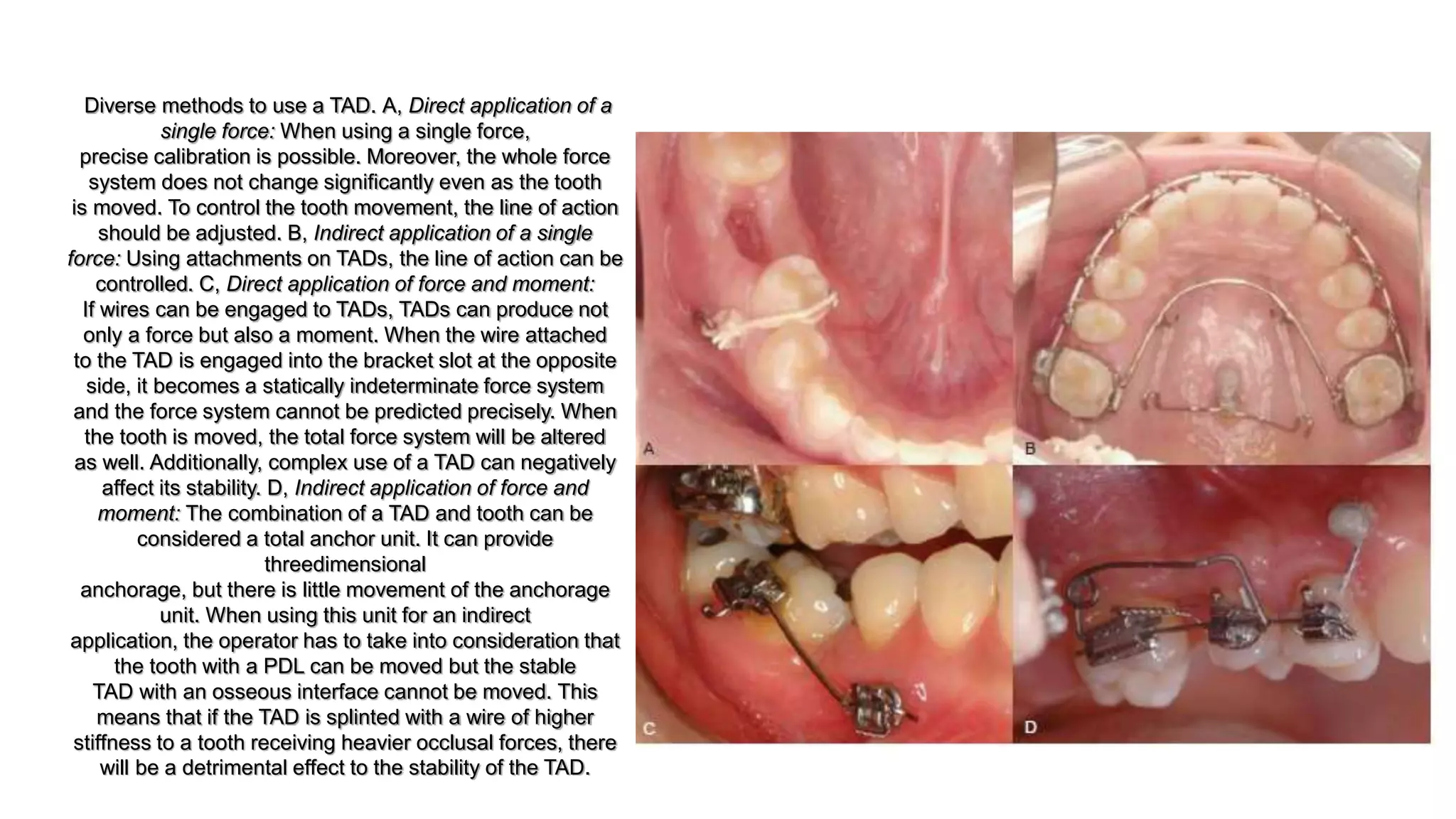 The use of microimplants in orthodontics | PPTX