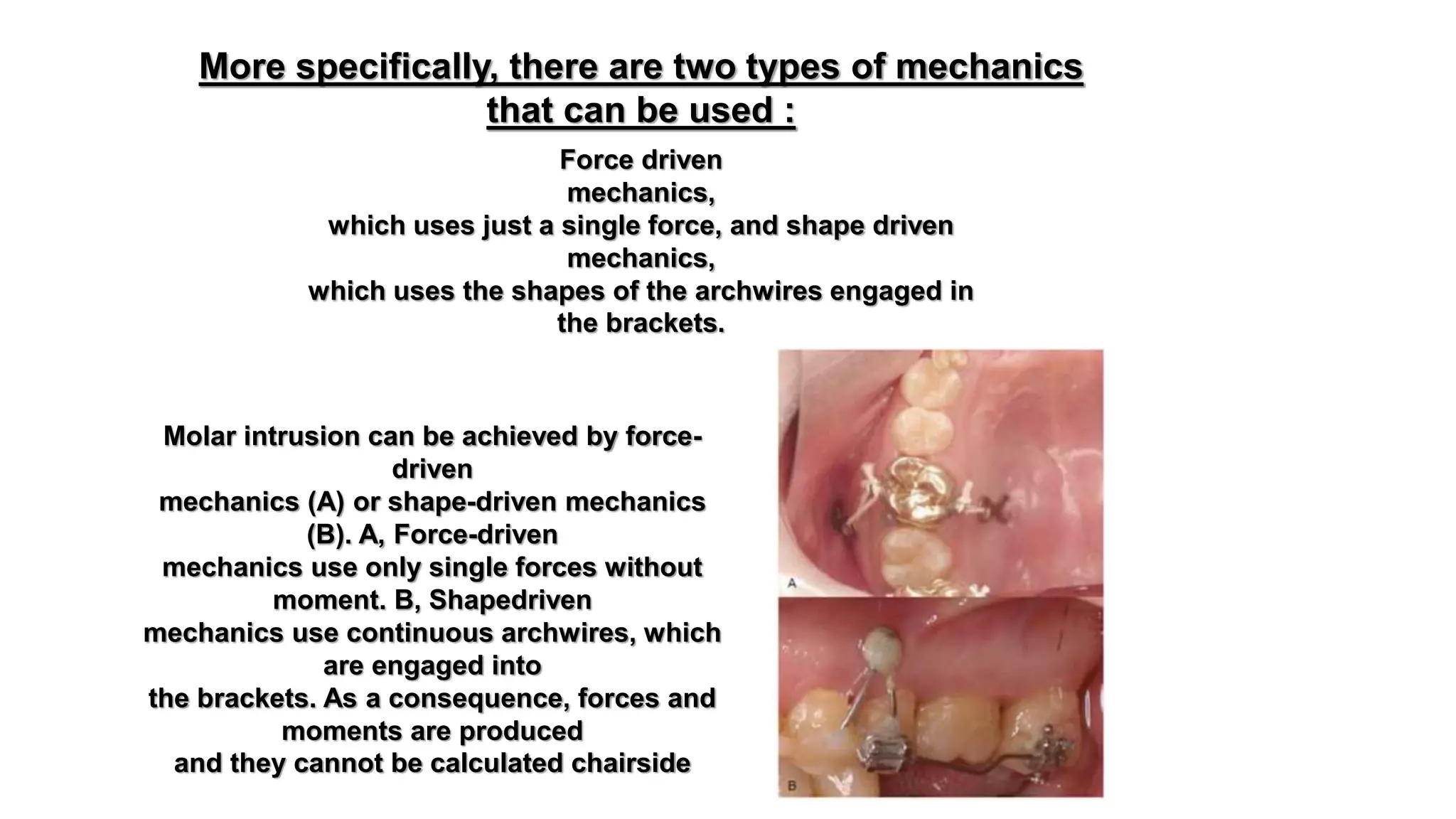 The use of microimplants in orthodontics | PPTX