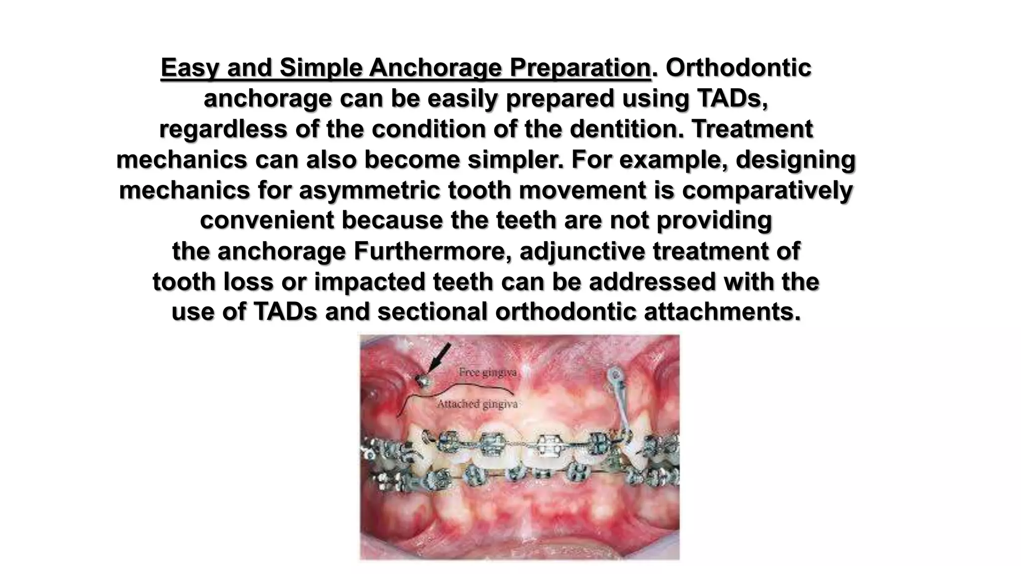 The use of microimplants in orthodontics | PPTX