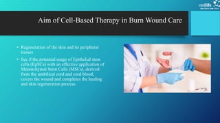 The use of stem cells in burnt wound treatment | PPTX