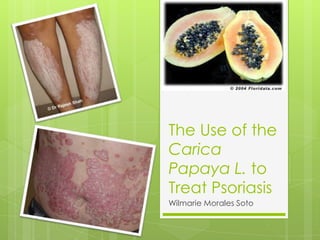 The Use of the CaricaPapaya L. to Treat Psoriasis Wilmarie Morales Soto 