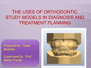 THE USES OF ORTHODONTIC
STUDY MODELS IN DIAGNOSIS AND
TREATMENT PLANNING
 