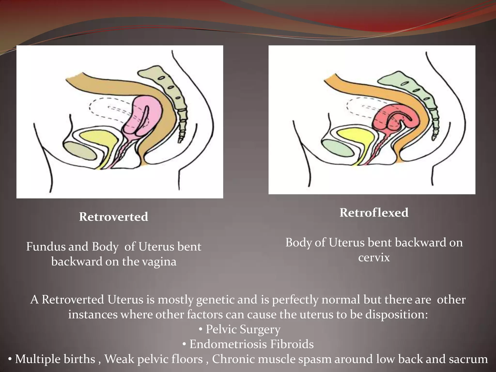 The Uterus by M. Mercado | PPTX