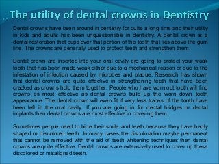 Dental crowns have been around in dentistry for quite a long time and their utility
in kids and adults has been unquestionable in dentistry. A dental crown is a
dental restoration that cups over that portion of the tooth that lies above the gum
line. The crowns are generally used to protect teeth and strengthen them.

Dental crown are inserted into your oral cavity are going to protect your weak
tooth that has been made weak either due to a mechanical reason or due to the
infestation of infection caused by microbes and plaque. Research has shown
that dental crowns are quite effective in strengthening teeth that have been
cracked as crowns hold them together. People who have worn out tooth will find
crowns as most effective as dental crowns build up the worn down teeth
appearance. The dental crown will even fit if very less traces of the tooth have
been left in the oral cavity. If you are going in for dental bridges or dental
implants then dental crowns are most effective in covering them.

Sometimes people need to hide their smile and teeth because they have badly
shaped or discolored teeth. In many cases the discoloration maybe permanent
that cannot be removed with the aid of teeth whitening techniques then dental
crowns are quite effective. Dental crowns are extensively used to cover up these
discolored or misaligned teeth.
 