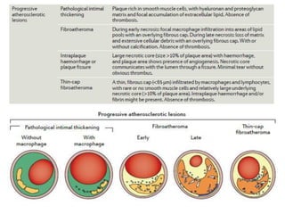 The vascular biology of atherosclerosis | PPTX